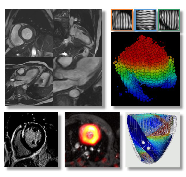 Enlarged view: MRI-Aufnahmen