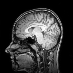 Enlarged view: MRI Kopf